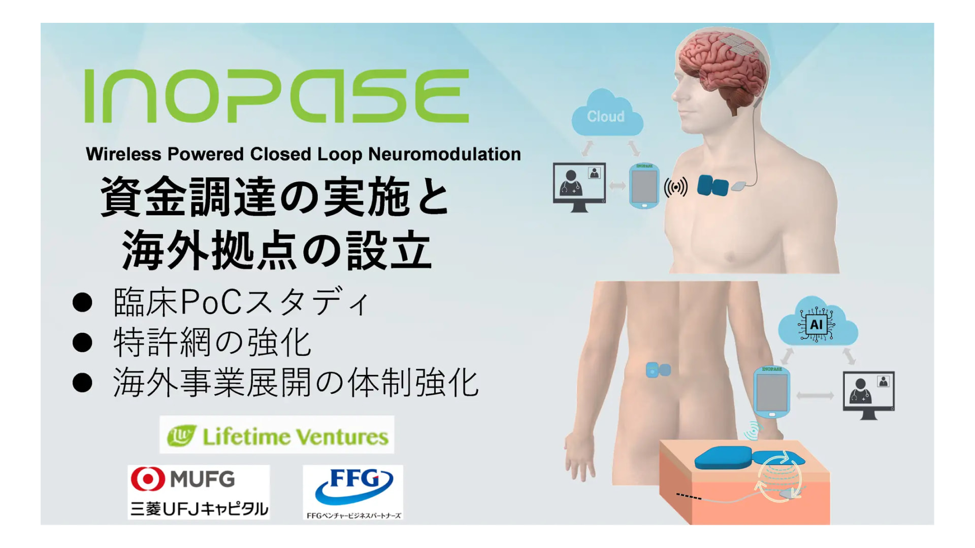 植込み型ニューロモデュレーションの開発に取り組む医療機器ベンチャー株式会社INOPASE、シードラウンドにて資金調達を実施